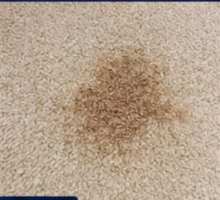 Food and drink stain before treatment